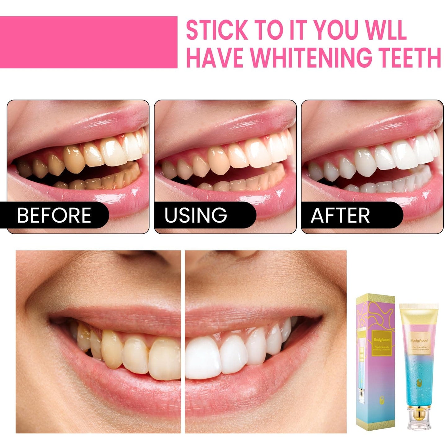 Whitening Toothpaste