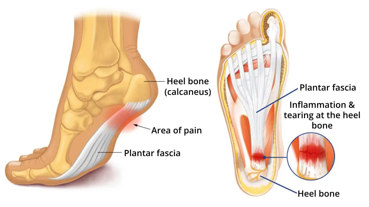 Revolutionary orthopedic insole