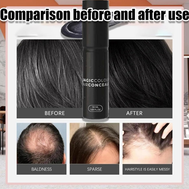🔥Last Day Sale - 50% Off🔥Scalp Concealer for Fuller, Natural-Looking Hair