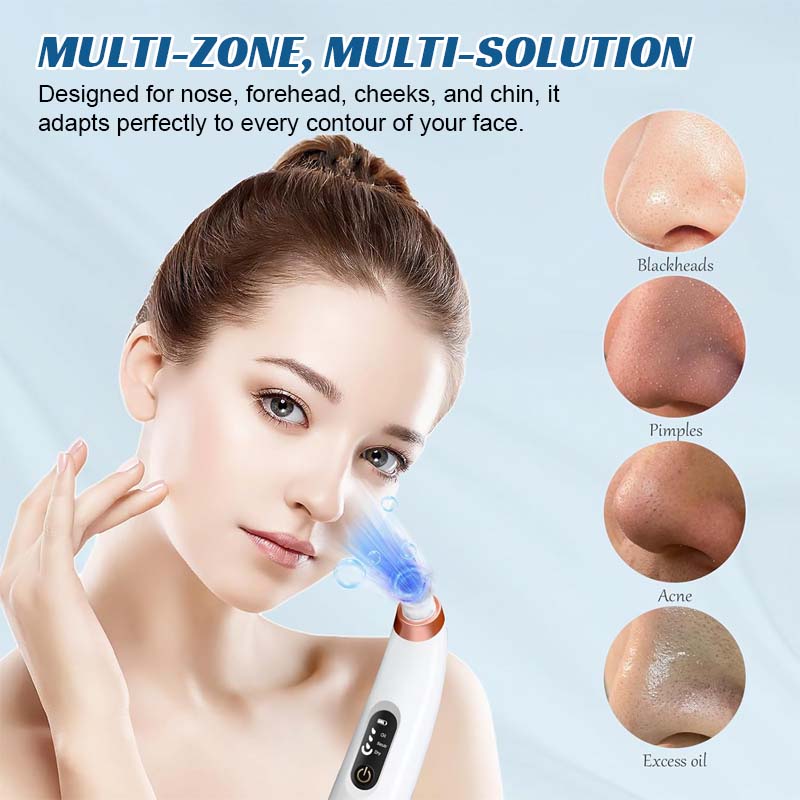 🌸 Gerät zur Tiefenreinigung der Poren